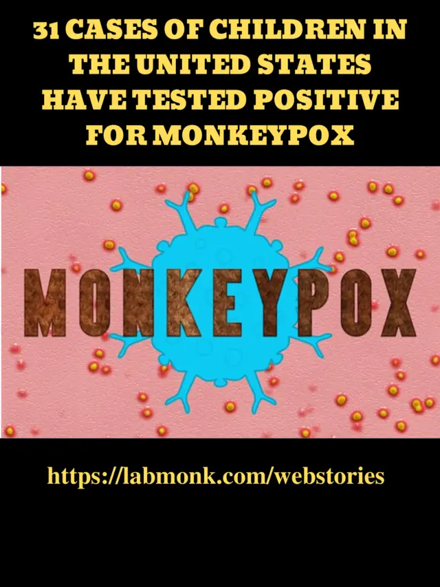 31 cases of children in the United States have tested positive for monkeypox