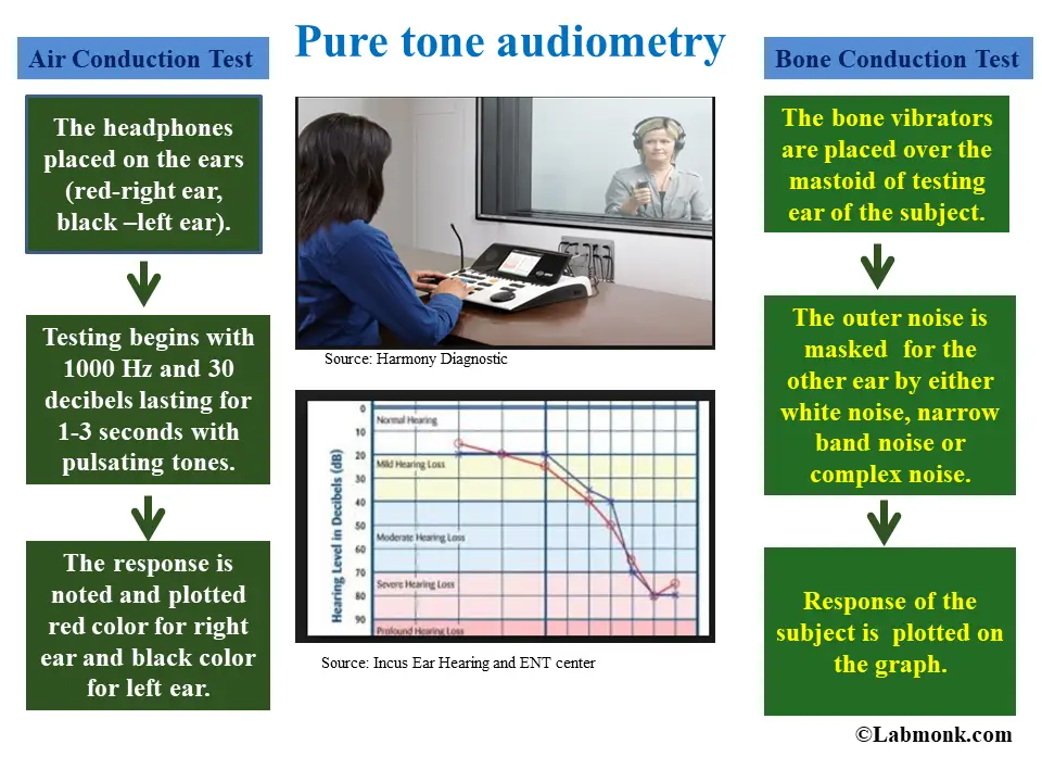 Pure tone audiometry
