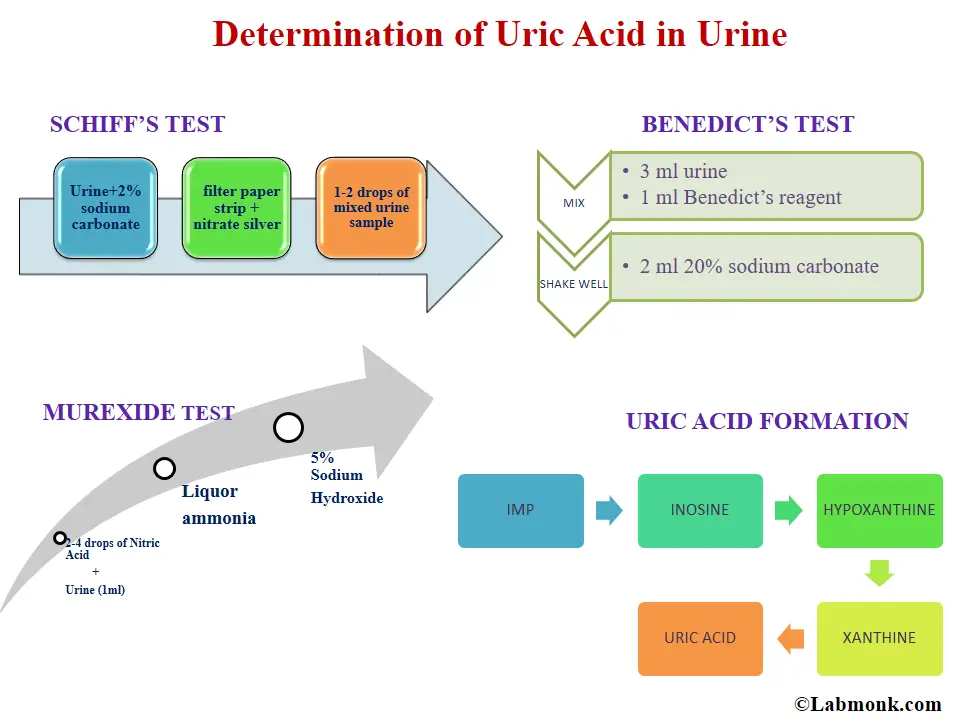 sodium urate in urine